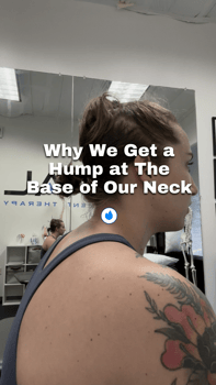 why we get a hump at the base of our neck