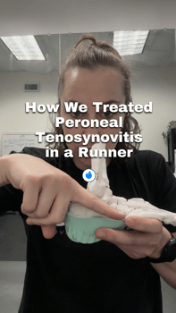 how we treated peroneal tenosynovitis in a runner