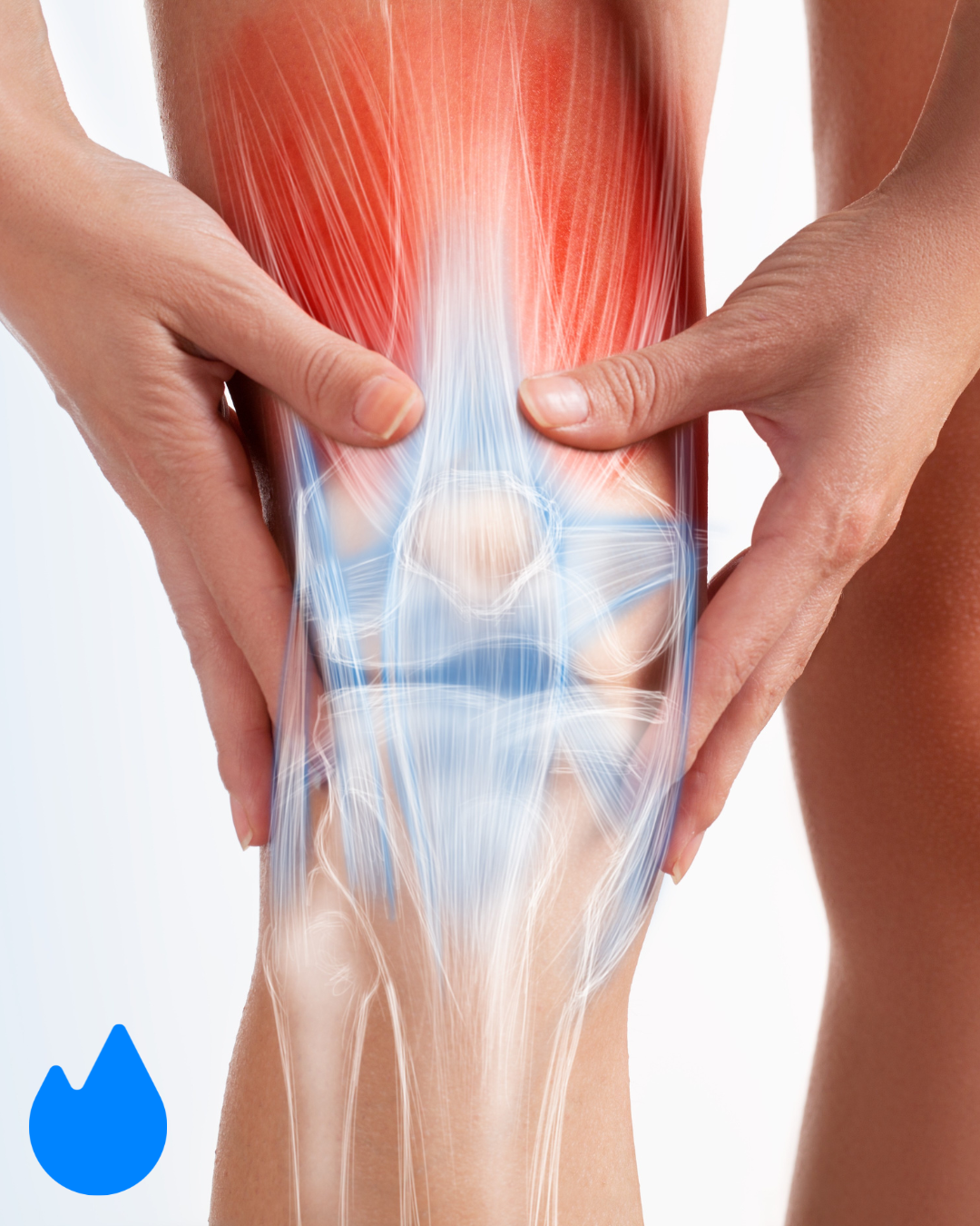 What’s REALLY Causing Your Knee Pain?