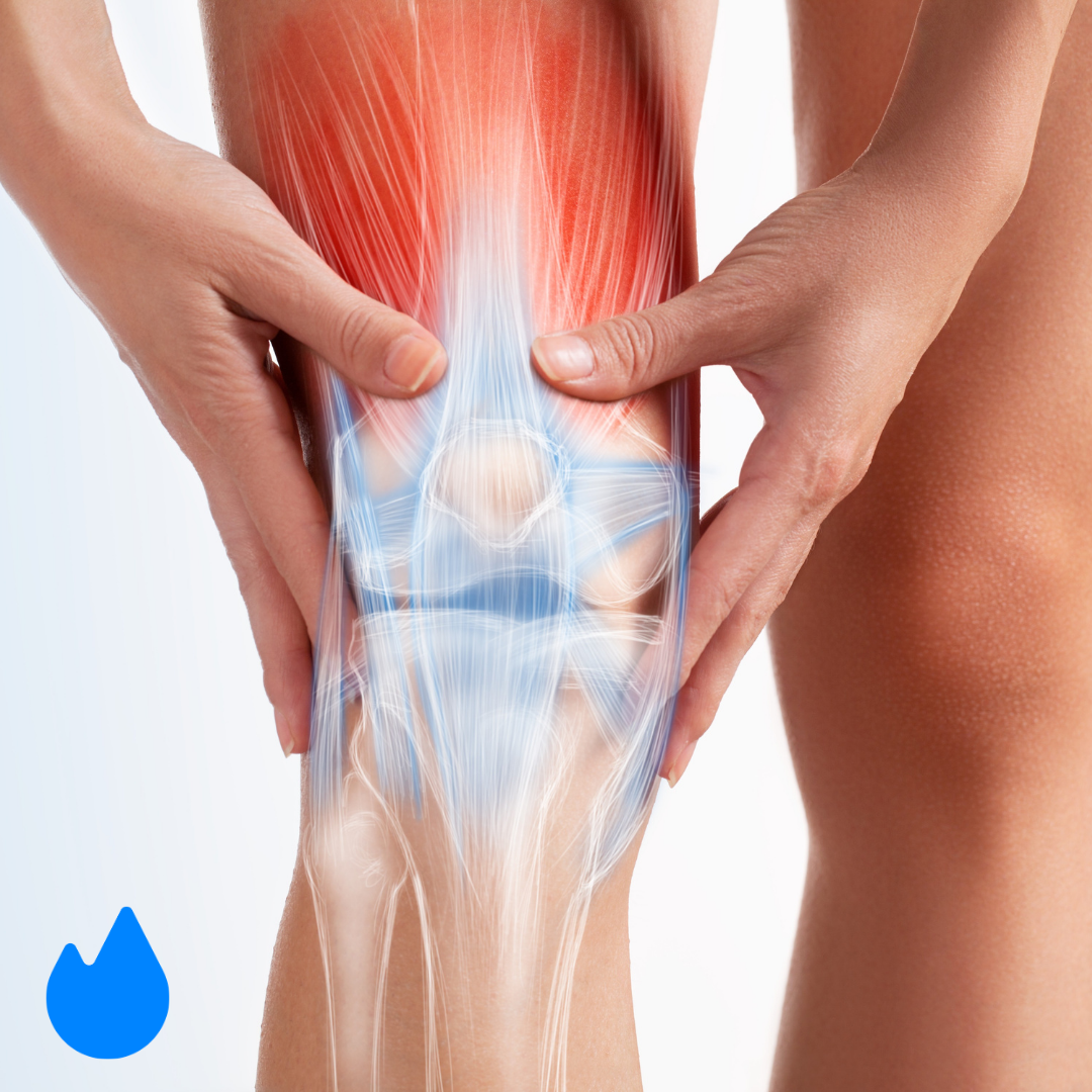 Whats REALLY Causing Your Knee Pain?